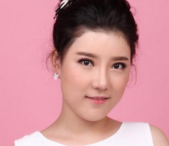 奇异果app：实拍：90后女子整容手术全历程用30天时候从“丑女”变美女(图6)