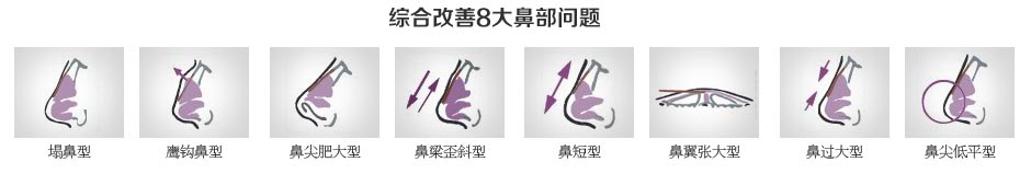 奇异果app：美莱归纳美鼻_广州隆鼻众少钱_隆鼻哪家好(图5)