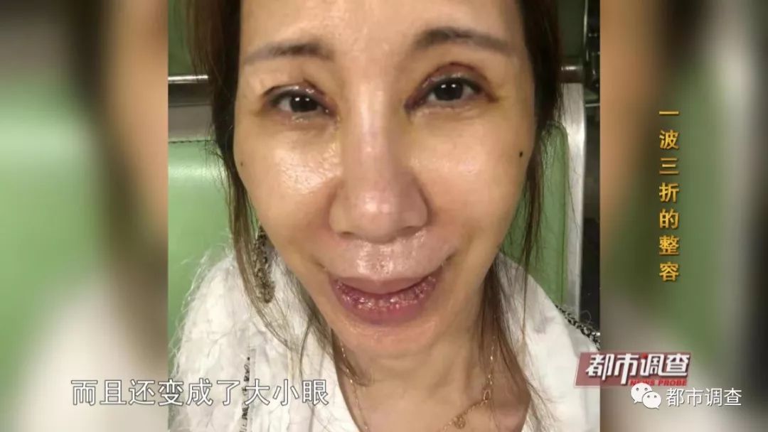 奇异果app官网下载：一波三折的整容